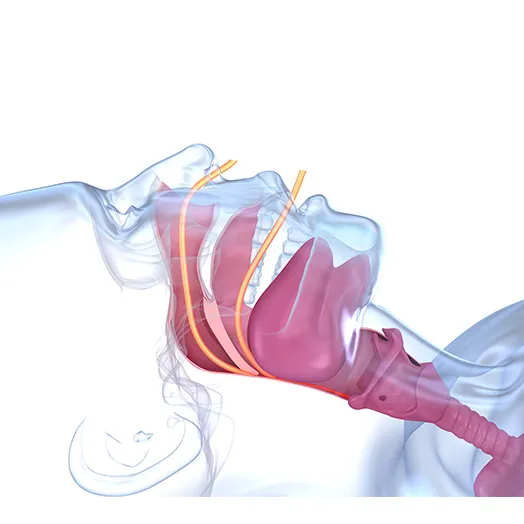 sleep study exam image